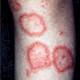 Lupus and the autoimmune process: The view from 2012 - EXPIRED Lupus and the autoimmune process: The view from 2012 - EXPIRED
