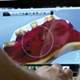 3-D technology may hasten denture sizing for residents 3-D technology may hasten denture sizing for residents