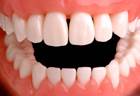 These dentures are clean, but that word doesn't describe what inspectors allegedly found at a Maryland assisted living facility in March. These dentures are clean, but that word doesn't describe what inspectors allegedly found at a Maryland assisted living facility in March.
