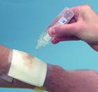 Saljet offers a cost-effective way to clean wounds in long-term care settings Saljet offers a cost-effective way to clean wounds in long-term care settings