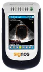 Portable ultrasound helps reduce urinary tract infections Portable ultrasound helps reduce urinary tract infections