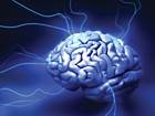 E-stim helps stroke patients E-stim helps stroke patients