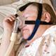 Elderly women with sleep apnea are at a great risk for dementia, study finds Elderly women with sleep apnea are at a great risk for dementia, study finds