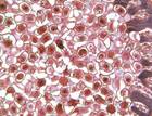 Worms may reveal insights into wound healing response Worms may reveal insights into wound healing response
