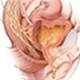 Urinary incontinence in the older female population - EXPIRED Urinary incontinence in the older female population - EXPIRED
