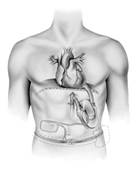 Taking heart: Technology is playing larger role in care Taking heart: Technology is playing larger role in care