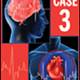 Case 3: An 80-Year-Old Woman with Atrial Fibrillation and Multiple Cardiovascular Risk Factors - EXPIRED Case 3: An 80-Year-Old Woman with Atrial Fibrillation and Multiple Cardiovascular Risk Factors - EXPIRED
