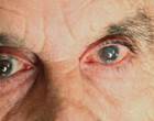 Better vision, less fractures Better vision, less fractures
