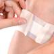 Plasma protein injections help chronic wounds heal Plasma protein injections help chronic wounds heal