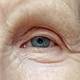Eye injections trim SNF use Eye injections trim SNF use