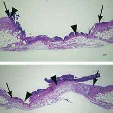 A synthetic BLT2 agonist helped wounds heal faster (bottom) than untreated wounds (top). A synthetic BLT2 agonist helped wounds heal faster (bottom) than untreated wounds (top).