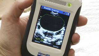 Handheld bladder scanner approved Handheld bladder scanner approved