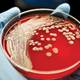 Hidden dangers: Protocols and best practices are needed to stave off bathing-acquired infections Hidden dangers: Protocols and best practices are needed to stave off bathing-acquired infections