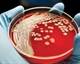 Hidden dangers: Protocols and best practices are needed to stave off bathing-acquired infections Hidden dangers: Protocols and best practices are needed to stave off bathing-acquired infections